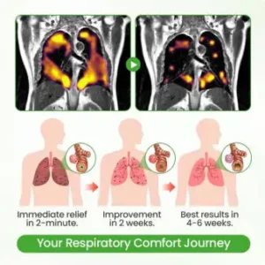 🌽✅𝐔𝐒 𝐎𝐰𝐧𝐞𝐝 𝐚𝐧𝐝 𝐎𝐩𝐞𝐫𝐚𝐭𝐞𝐝：𝐂𝐚𝐫𝐞𝐁𝐫𝐞𝐞𝐳𝐞® 𝐁𝐨𝐭𝐚𝐧𝐢𝐜𝐚𝐥 𝐌𝐮𝐥𝐥𝐞𝐢𝐧 𝐋𝐮𝐧𝐠 𝐂𝐥𝐞𝐚𝐧𝐬𝐞 𝐃𝐢𝐟𝐟𝐮𝐬𝐞𝐫(🫁Cough, wheezing, shortness of breath, sputum, stuffy nose, bronchitis, bronchitis, allergy symptoms, lung discomfort💝)