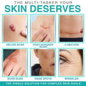 ✨ LAST DAY BUY 1 GET 1 FREE✨CareBreeze® 3-in-1 Microneedle Care Patch