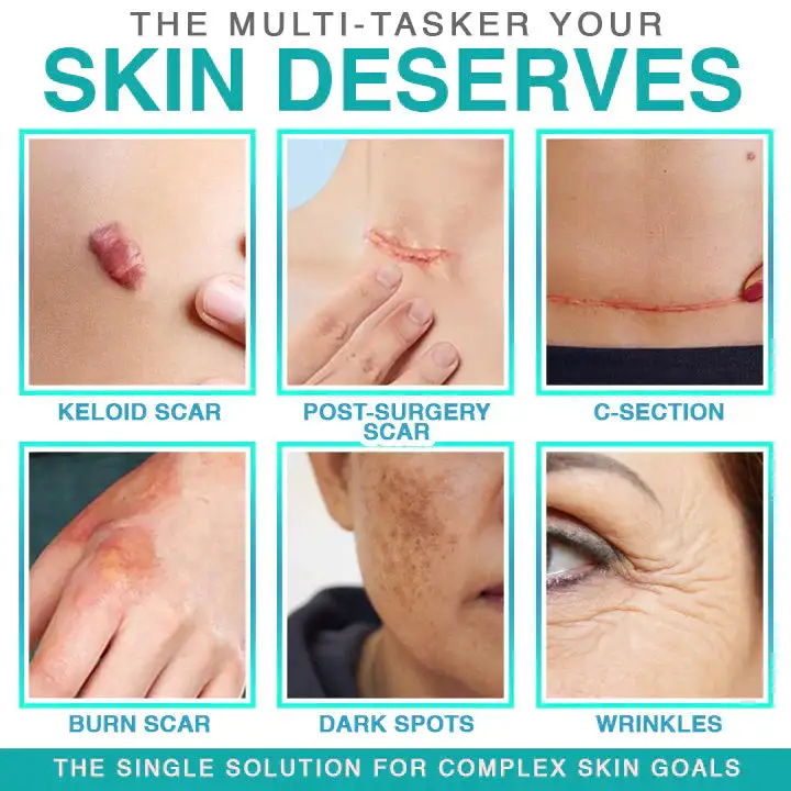 ✨ LAST DAY BUY 1 GET 1 FREE✨CareBreeze® 3-in-1 Microneedle Care Patch