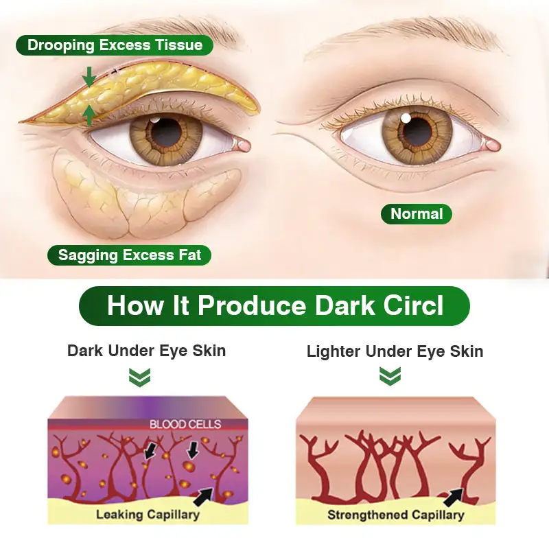 ✅US Owned & Operated:CareBreeze® Pepti-Tox & Caffeine Shot Wrinkle-Lift Depuffing Microdart Patch- ⚡Last Day Promotion 70% OFF