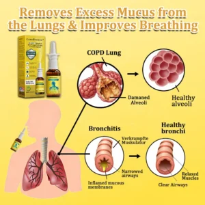 ⚡🐝✅US Official Store:CareBreeze® 6-in-1 Herbal BeePropolis Lung Cleanse Spray（👨‍⚕️Directly acts on COPD, asthma, chronic bronchitis (CB), respiratory infections, lung cancer, sinusitis, and other conditions）