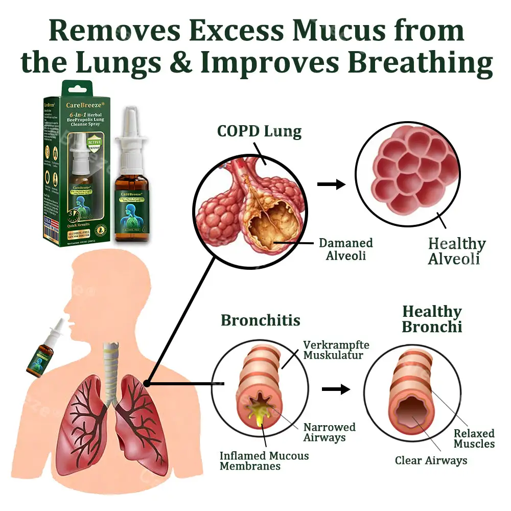 ⚡💖🇺🇸 Official Store:CareBreeze® 6-in-1 Herbal BeePropolis Lung Cleanse Spray(🫁Cough, wheezing, shortness of breath, sputum, stuffy nose, bronchitis, bronchitis, allergy symptoms, lung discomfort💝)