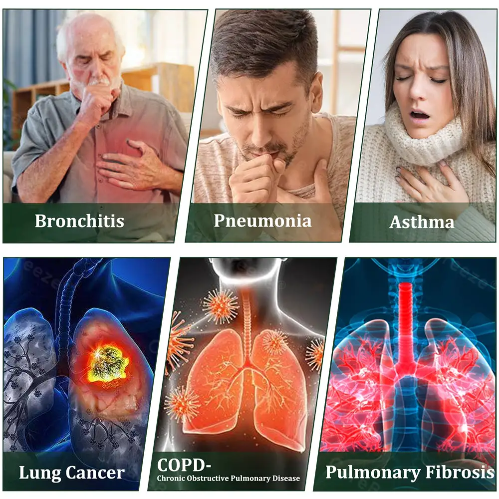 ⚡💖🇺🇸 Official Store:CareBreeze® 6-in-1 Herbal BeePropolis Lung Cleanse Spray(🫁Cough, wheezing, shortness of breath, sputum, stuffy nose, bronchitis, bronchitis, allergy symptoms, lung discomfort💝)