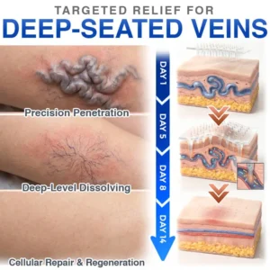 CareBreeze® Varicose Veins Treatment Microneedle Patch
