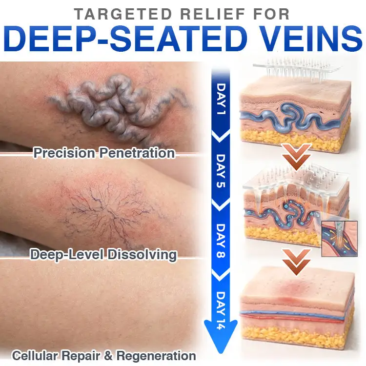 CareBreeze® Varicose Veins Treatment Microneedle Patch