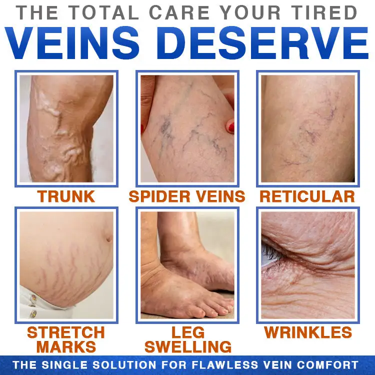 CareBreeze® Varicose Veins Treatment Microneedle Patch