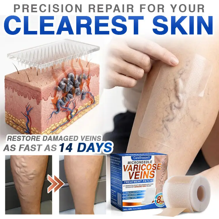 CareBreeze® Varicose Veins Treatment Microneedle Patch