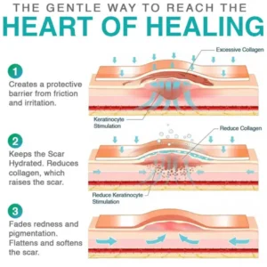 CareBreeze® 3-in-1 Scar Removal Microneedle Care Patch 💡