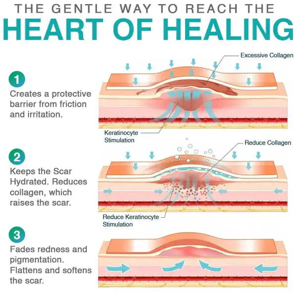 CareBreeze® 3-in-1 Scar Removal Microneedle Care Patch 💡
