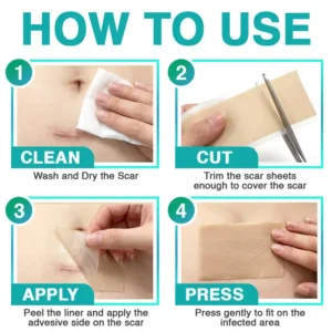 CareBreeze® 3-in-1 Scar Removal Microneedle Care Patch 💡