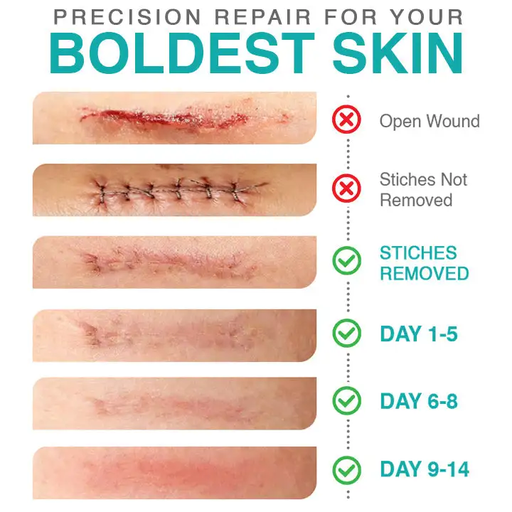 CareBreeze® 3-in-1 Scar Removal Microneedle Care Patch 💡