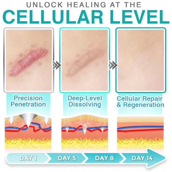 CareBreeze® 3-in-1 Scar Removal Microneedle Care Patch 💡