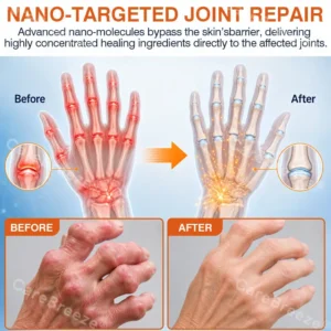 ✅🇺🇸 CareBreeze® Pain-Relief Bone-Healing Microneedle Patch(🧑⚕️Reducing joint swelling, pain, stiffness, redness, warmth, soreness, and joint fatigue)