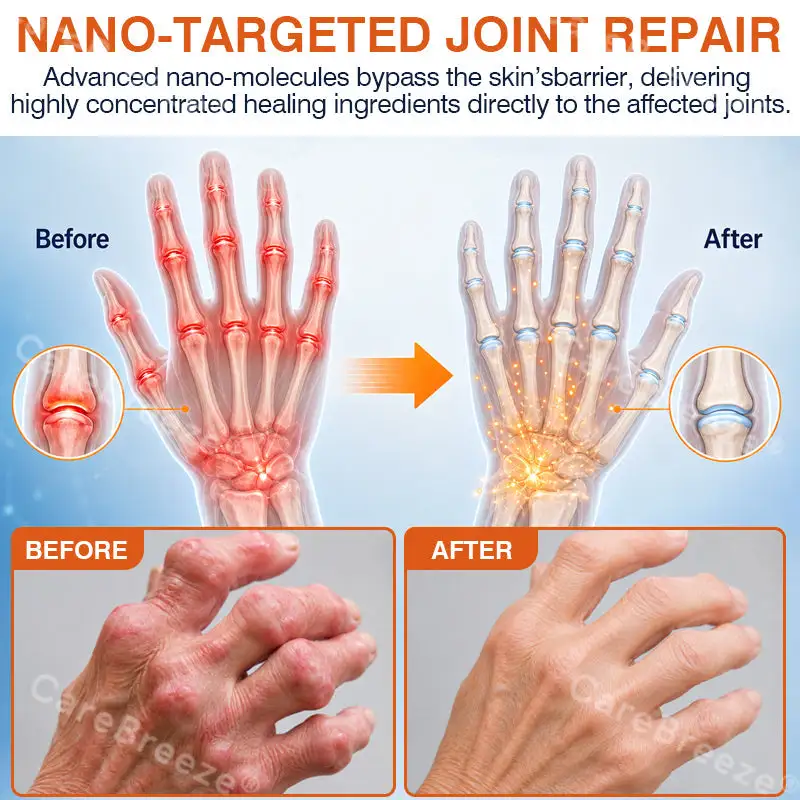 ✅🇺🇸 CareBreeze® Pain-Relief Bone-Healing Microneedle Patch(🧑⚕️Reducing joint swelling, pain, stiffness, redness, warmth, soreness, and joint fatigue)