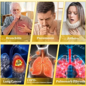 🐝🇺🇸 Official Store:CareBreeze® 6-in-1 Herbal BeePropolis Lung Cleanse Spray(👨⚕️Directly acts on COPD, asthma, chronic bronchitis (CB), respiratory infections, lung cancer, sinusitis, and other conditions🫁)