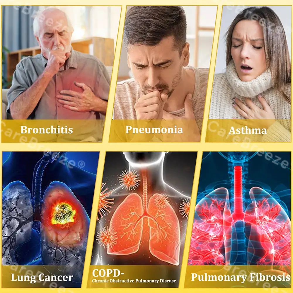 🐝🇺🇸 Official Store:CareBreeze® 6-in-1 Herbal BeePropolis Lung Cleanse Spray(👨⚕️Directly acts on COPD, asthma, chronic bronchitis (CB), respiratory infections, lung cancer, sinusitis, and other conditions🫁)