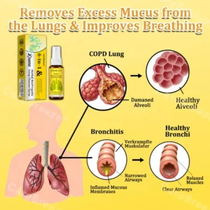 🐝🇺🇸 Official Store:CareBreeze® 6-in-1 Herbal BeePropolis Lung Cleanse Spray(👨⚕️Directly acts on COPD, asthma, chronic bronchitis (CB), respiratory infections, lung cancer, sinusitis, and other conditions🫁)
