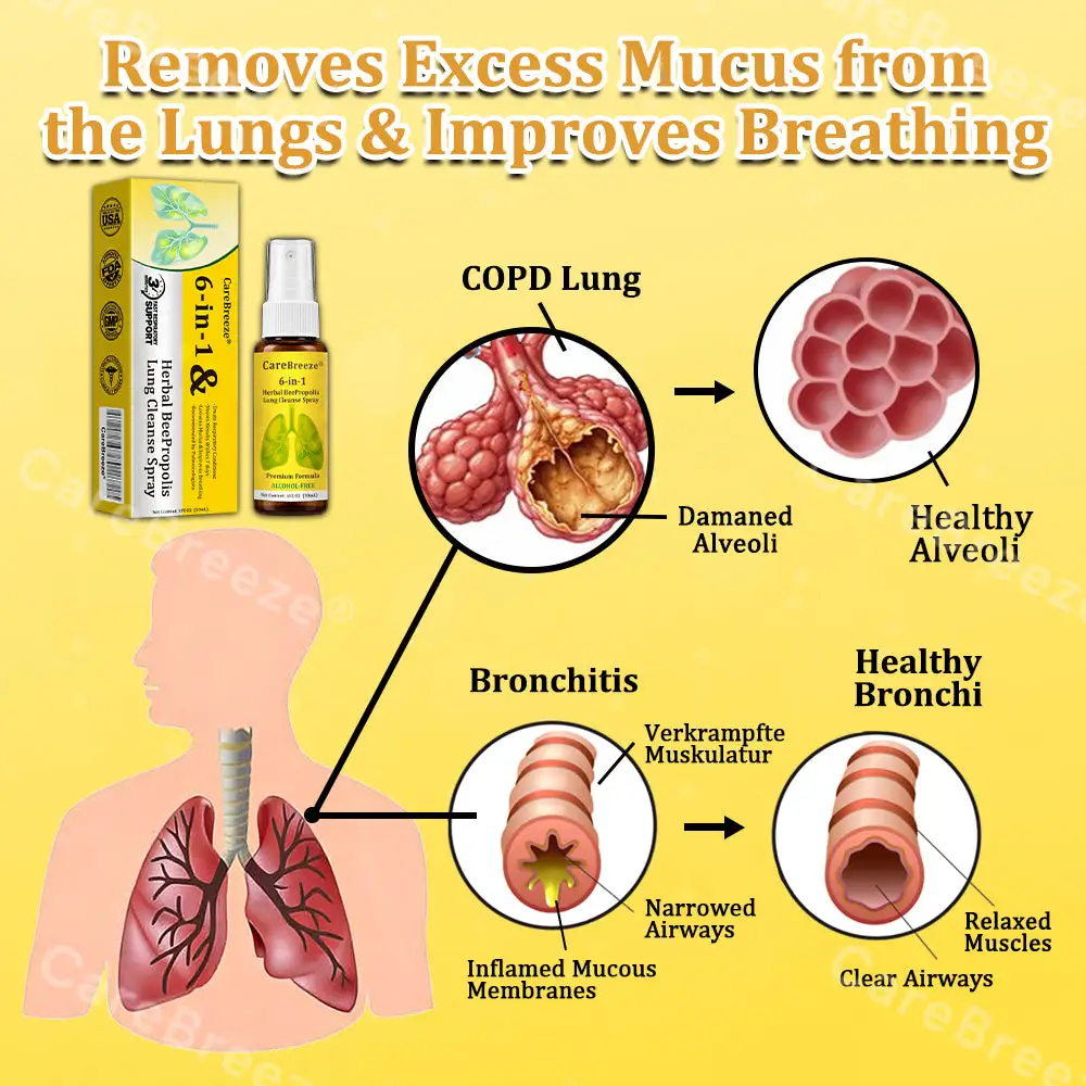 🐝🇺🇸 Official Store:CareBreeze® 6-in-1 Herbal BeePropolis Lung Cleanse Spray(👨⚕️Directly acts on COPD, asthma, chronic bronchitis (CB), respiratory infections, lung cancer, sinusitis, and other conditions🫁)