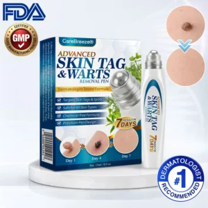 🇺🇸 CareBreeze® Advanced Skin Tag & Wart Removal Roller 🧑🏼⚕️