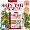 🇺🇸 CareBreeze® Herbal Skin Tag & Wart Removal Roller 🧑🏼‍⚕️