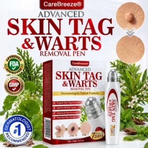 🇺🇸 CareBreeze® Herbal Skin Tag & Wart Removal Roller 🧑🏼⚕️